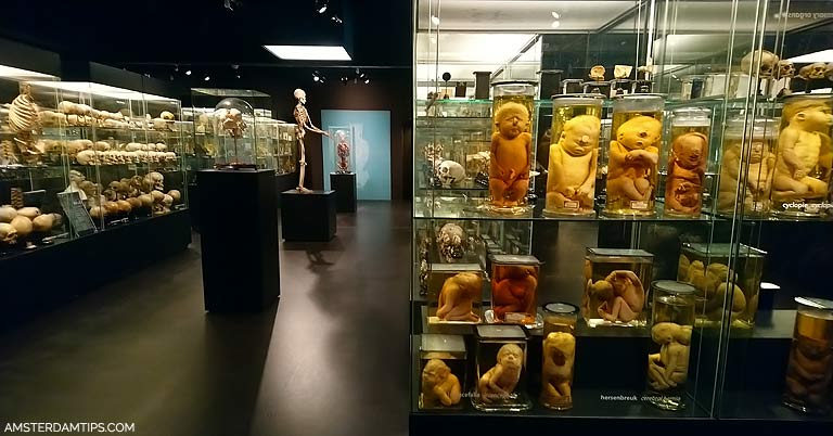 museum vrolik amsterdam